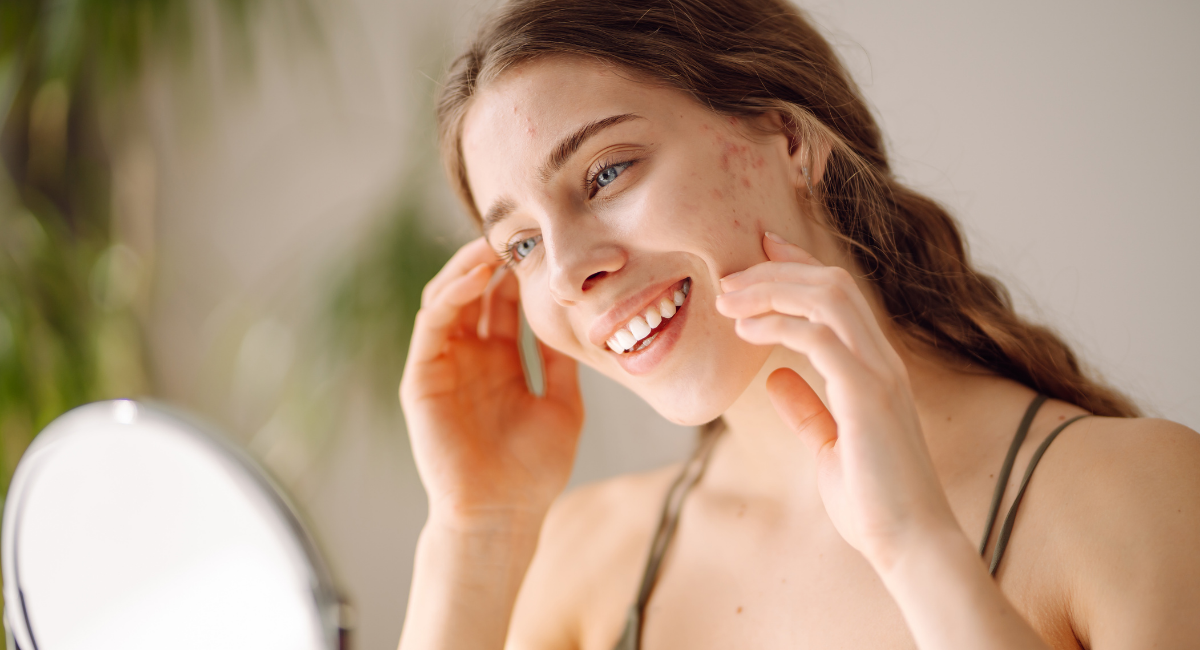 Pigmentové skvrny vyžadují každodenní péči.